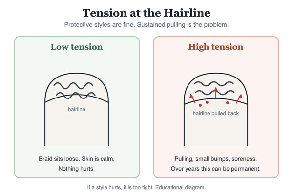 Illustration comparing a loose protective braid with a tight braid pulling on the hairline