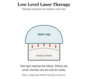 Diagram of a low level laser therapy cap directing light at the scalp surface